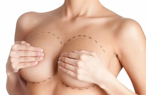 mamoplastia bröstlyft